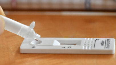 Liberação de autotestes pode sair nesta sexta-feira