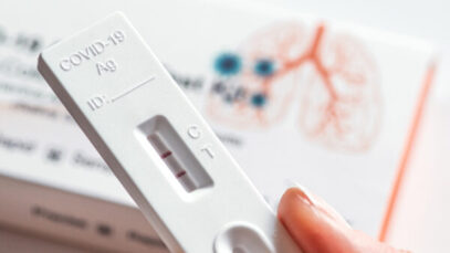 Janeiro já teve mais testes positivos do que dezembro