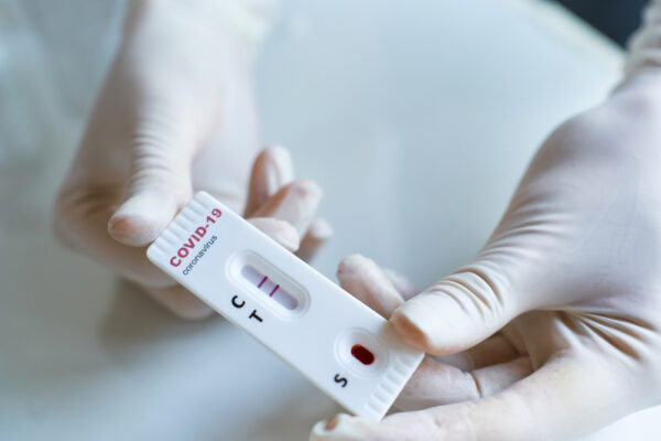 Imagem relacionada a: Índice de positivos da Covid-19 quase dobra