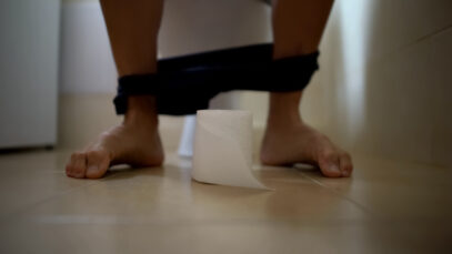 Como tratar hemorroidas