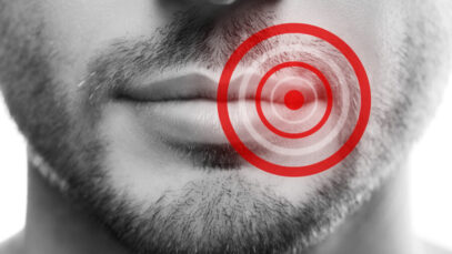 Como curar a herpes labial rapidamente