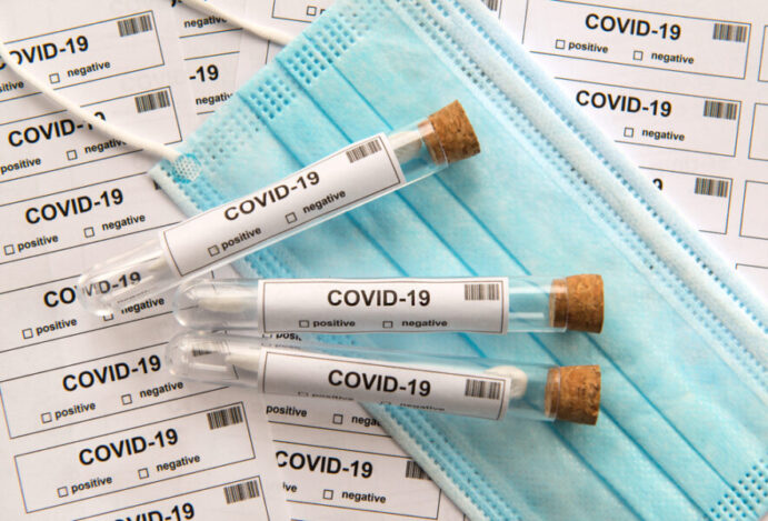 Casos da Covid em farmácias