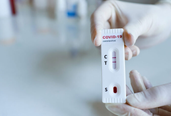 Testes positivos da Covid-19