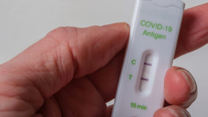 Casos de Covid em farmácias seguem acima de 30%