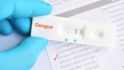 Pesquisa ressalta peso de testes rápidos para serviços farmacêuticos Pesquisa ressalta peso de testes rápidos para serviços farmacêuticos