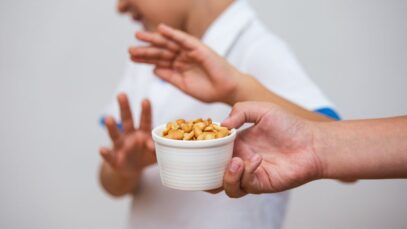 Veja os casos mais comuns de alergia a alimentos