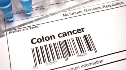 Ubuntu Med quer vender testes de câncer em farmácias