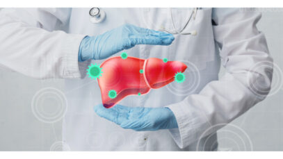 Madrigal recebe aporte de US$ 300 mi para o Resmetirom