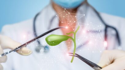 cirurgia de vesícula