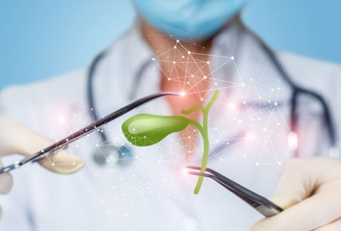 cirurgia de vesícula