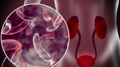 infecção urinária