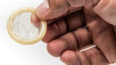 alergia à camisinha