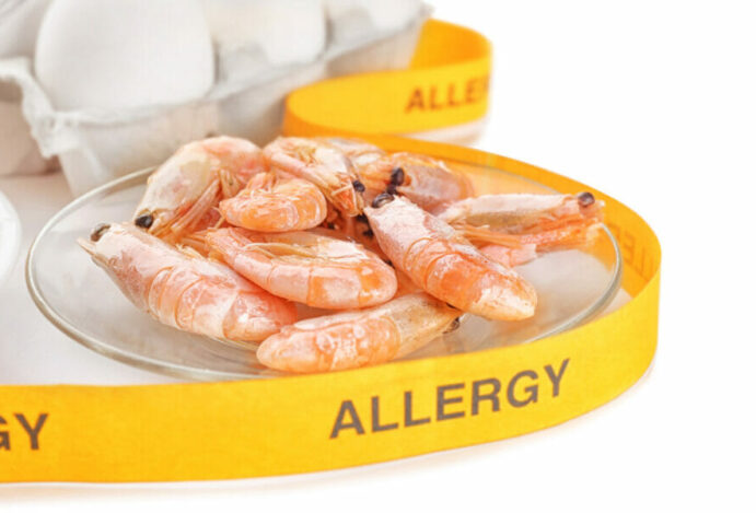 Imagem relacionada a: Muita atenção com alergia a camarão