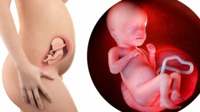 26 semanas de gestação