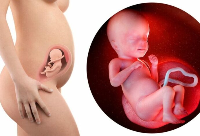 26 semanas de gestação