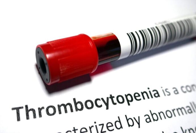 Plaquetas baixas