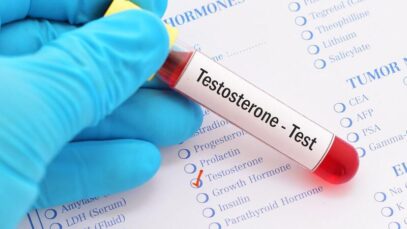 Testosterona