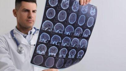 Quais os sintomas iniciais da esclerose múltipla?