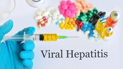 Hepatites virais