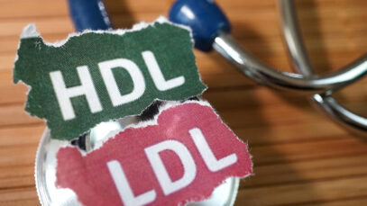 Medicamento para colesterol tem resultado promissor