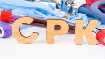 CPK