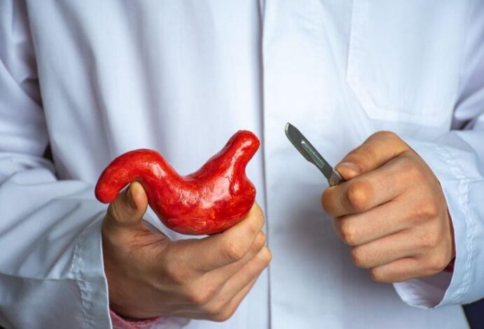 Cirurgia bariátrica