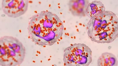 Infecções sexualmente transmissíveis