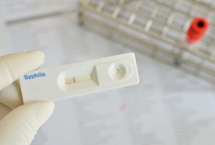 sífilis