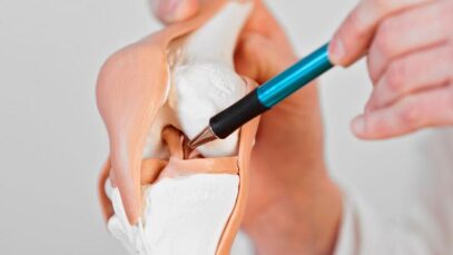 lesão de ligamento cruzado