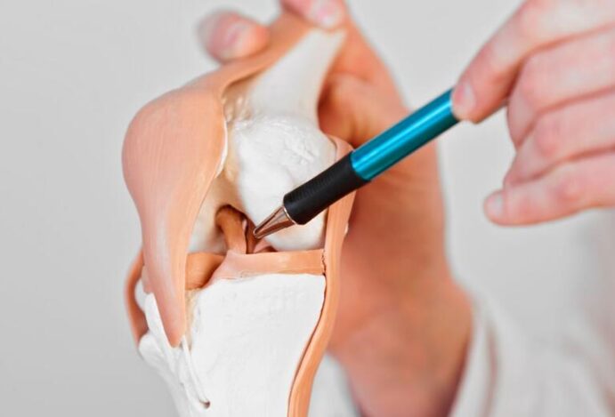 lesão de ligamento cruzado