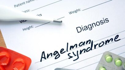 Síndrome de Angelman