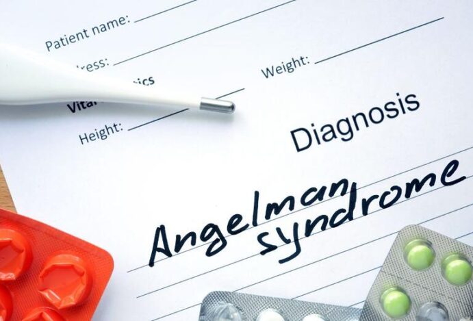 Síndrome de Angelman