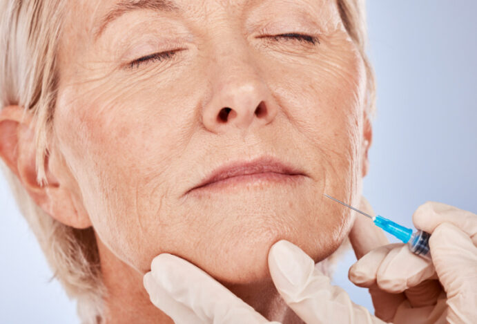 Preenchedores faciais