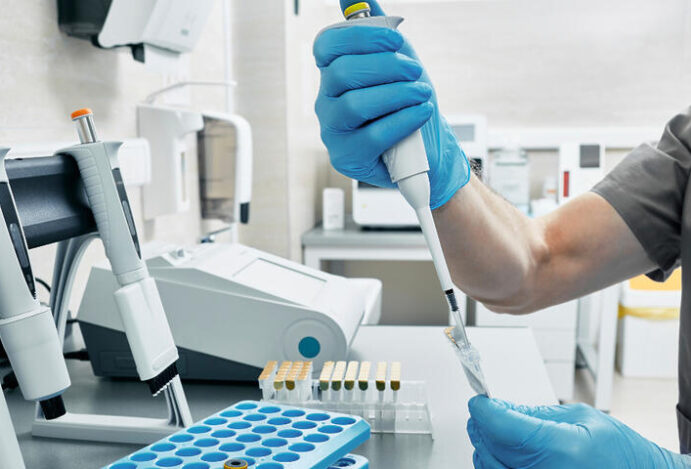 Teste rápido de HIV