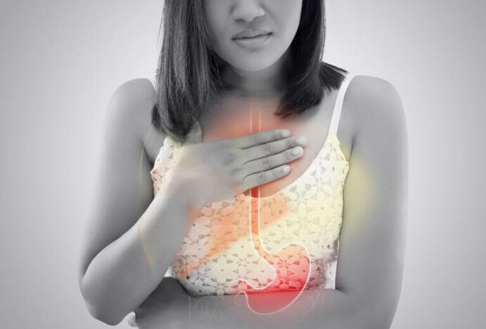 refluxo gastroesofágico