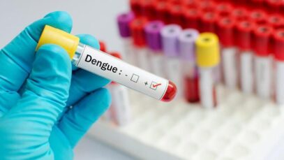 Dengue
