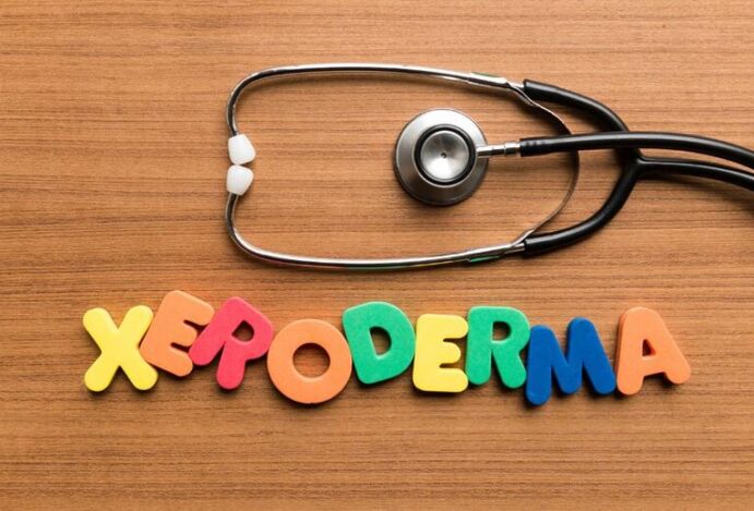 xeroderma pigmentoso