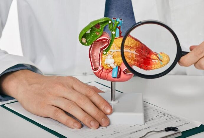 Câncer de pâncreas