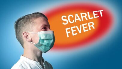 Escarlatina