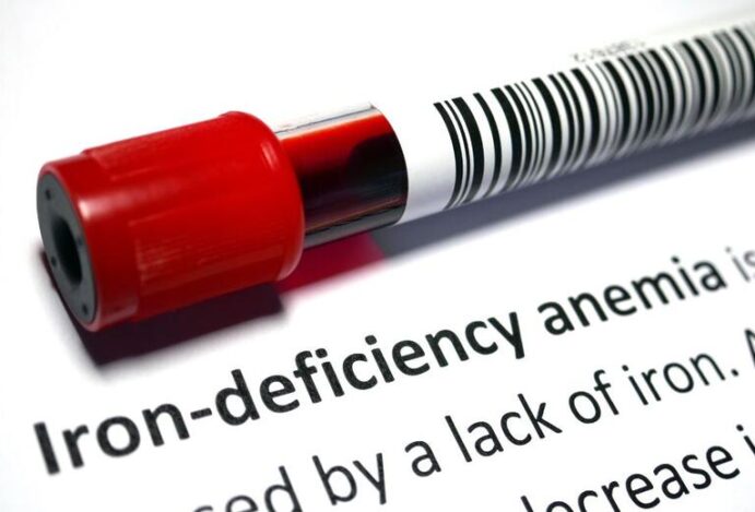 Deficiência de ferro