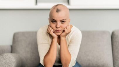 Alopecia
