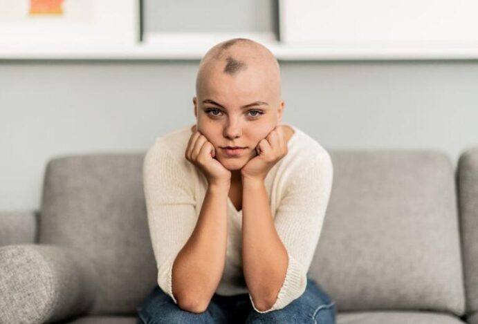 Alopecia
