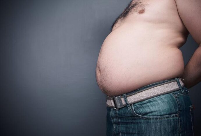 Sobrepeso