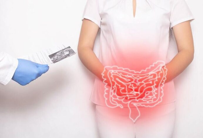 Câncer de intestino