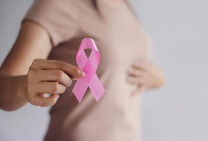 Câncer de mama