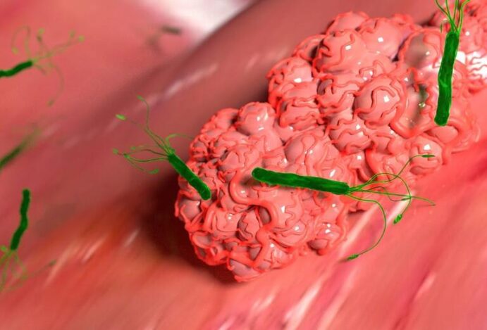 H Pylori