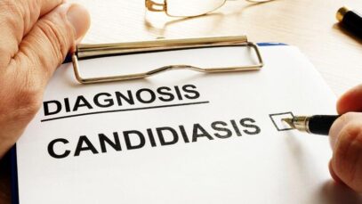candidíase
