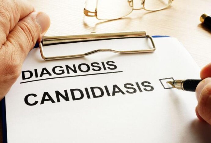 candidíase