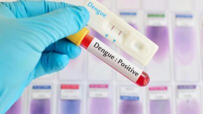 Autotestes para dengue entra na pauta da Anvisa e da Saúde