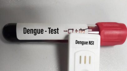 Anvisa promete agilizar aprovação de testes de dengue
